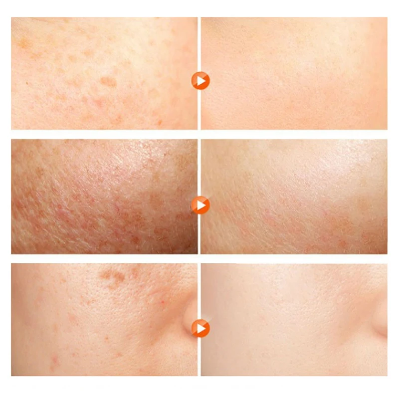 

Snail Arbutin Whitening Cream Moisturizing Reduce Melanin Cream Squalane Anti-oxidant Fade Spots Freckles Smooth Skin Face Cream