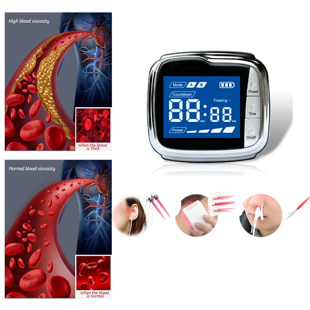 

Diode 650nm lllt Medical Laser Watch to Reduce High Blood Pressure Hypertension Diabetes Watches GD10-D