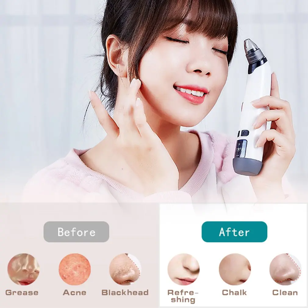 Устройство для удаления черных точек вакуумное очищающее средство пор на лице