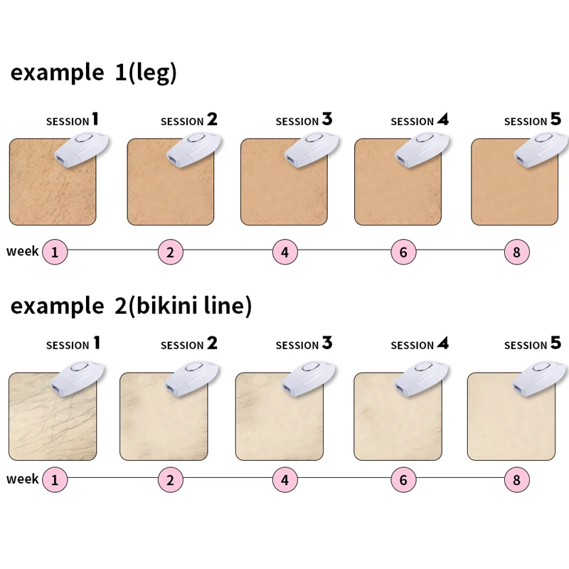 ИПЛ Эпилятор Лазерное удаление волос 600000 вспышек Профессиональный Постоянный Электрический Фото-безболезненный Нитьевой Удалитель для всего тела.