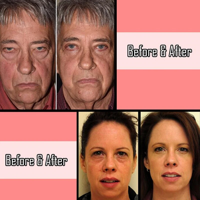 Eye Delight Boost Serum Instant Lifting Liquid Pump Eye Bag Removal Cream Effect Puffiness Wrinkles Fine Lines Dark Circles