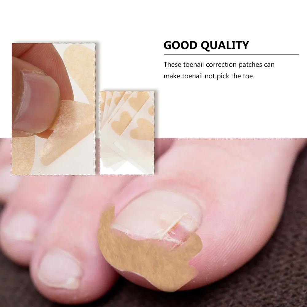 

60pcs Ingrown Toenail Correction Patch Tape Stickers Toenail Stickers (Beige)