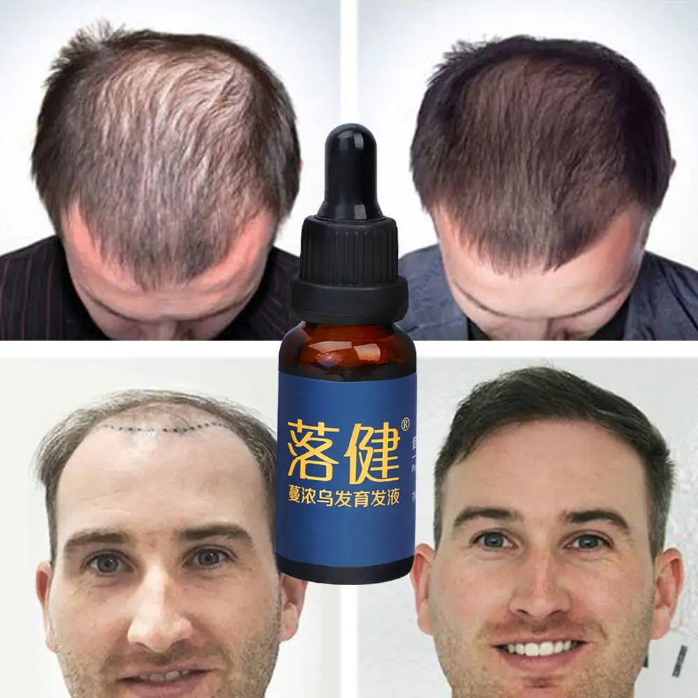 

Hair growth essence oil anti-hair loss treatment beard growth oil repair damaged hair root hair care products conditioner