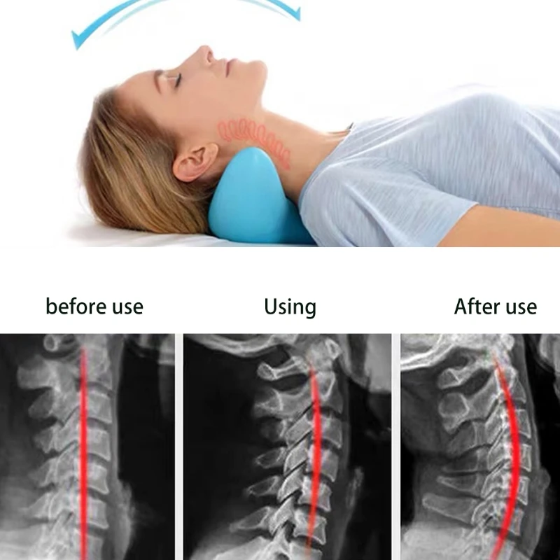 

Neck Stretcher for Pain Relief Neck and Shoulder Relaxer Chiropractic Acupressure Trigger Point Pillows Cervical Traction