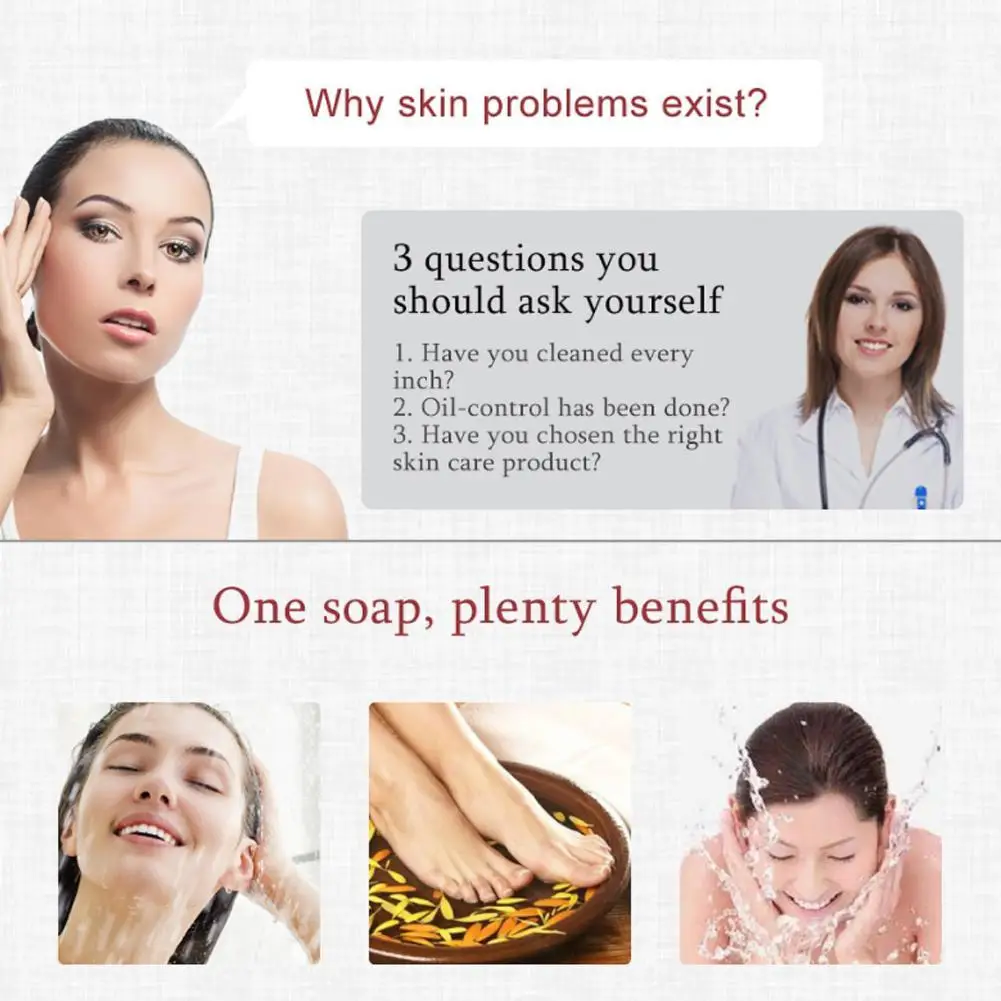 

80g Sulfur Soap Skin Conditions Acne Psoriasis Seborrhea Eczema Anti Fungal Bath Whitening Soap Shampoo Handmade Soap