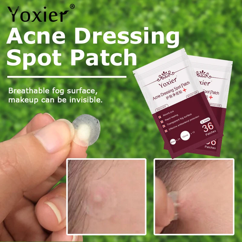 36pcs/sheet Skin Tag Remover Pimple Master Patch Treatment Invisible Acne Stickers Patch Acne Concealer Tags Makeup Tools TSLM1