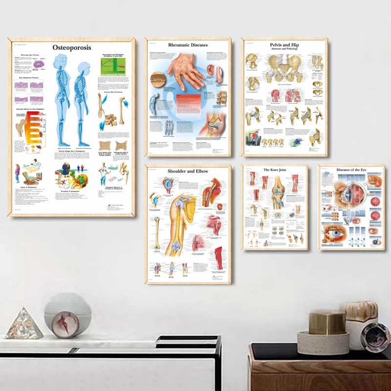 

Map Silk Painting Wall Pictures For Medical Education Office Home Decor Human Anatomy Muscle System Body Art Poster Canvas