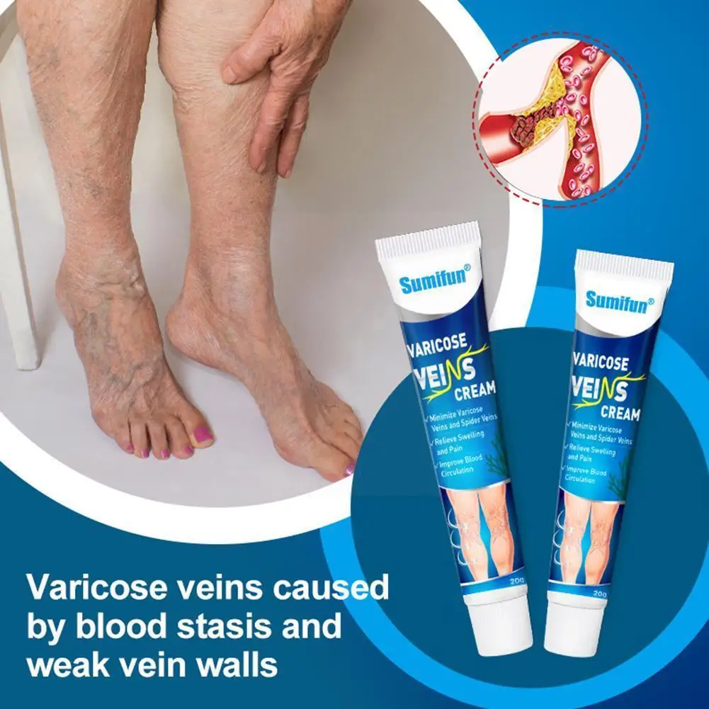 

​20g Varicose Vein Cream Anti-bacterial Effective Red Repair Leg Ointment Streak Vasculitis Phlebitis blood Treatment Raise K8N8