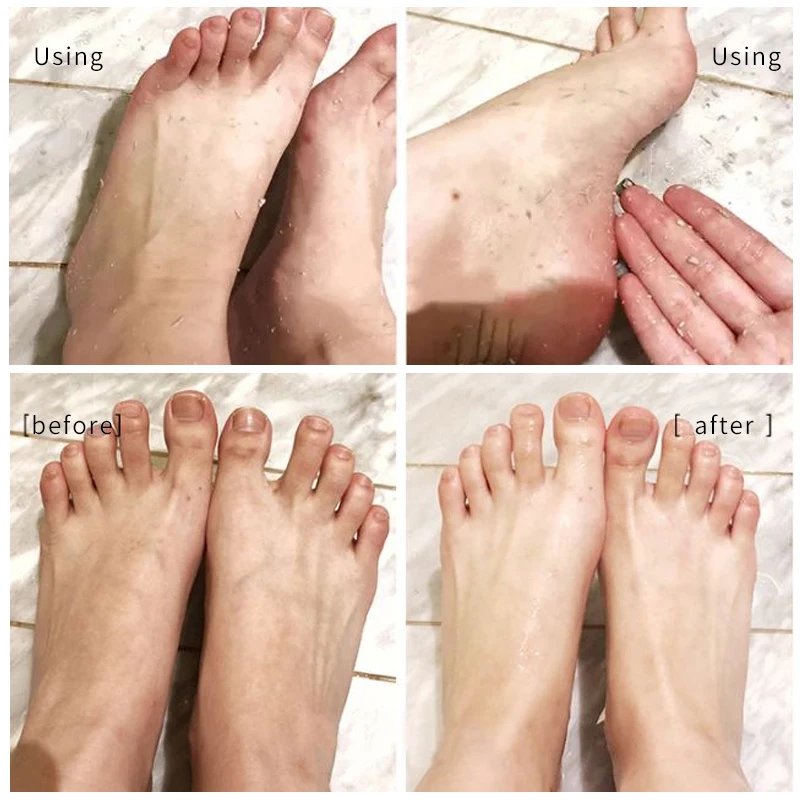 

Japan Cosmetics Foot Peeling Spray Natural Orange Essence Pedicure Hands Dead Skin Exfoliator Mask Whiten Baby Foot Care Tool