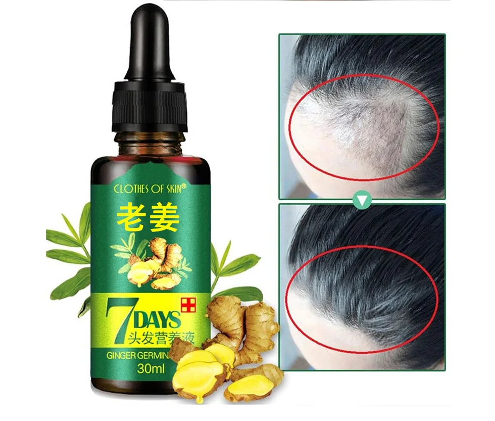 Имбирное масло для роста волос питательный раствор эссенция жидкость быстрого