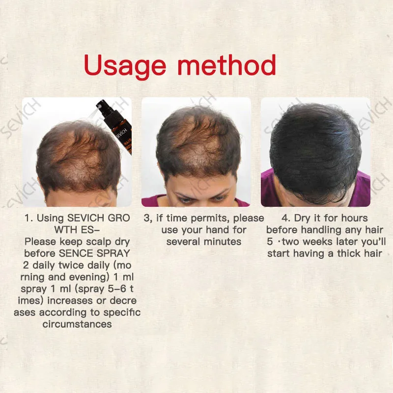 

Hair Ginger Regeneration Spray Hair Natural Growth Repair Damaged Hair 30ml TSLM1