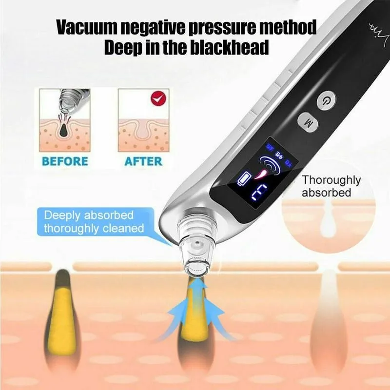 

Electric Acne Remover Vacuum Suction Pore Cleaner Blackhead Acne Remover Nose Skin Care Beauty Cleaning Tool