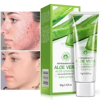 aloe vera gel face cream moisturizing anti inflammation anti acne shrink pores sunburn repair soothe oil control brighten 40g
