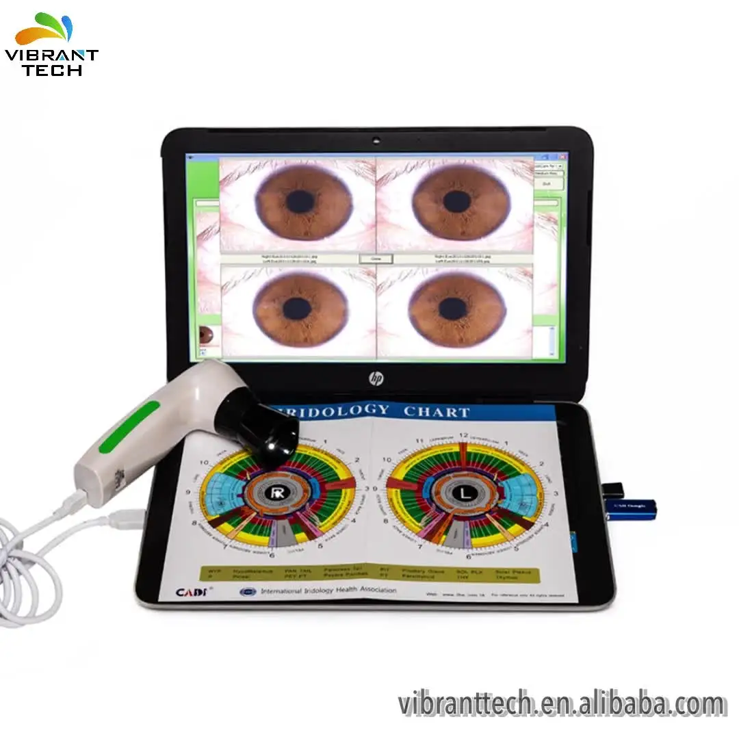 

Аппарат для сканирования тела, биометрическая Иридология глазного глаза, ирископ, камера/Оборудование для камер для здоровья, цифровой ана...