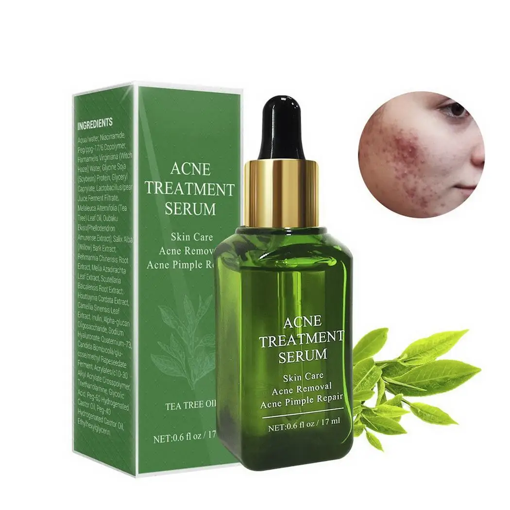 Угревая угревая головка усадка поры ремонт Сделано Китай маска для носа против