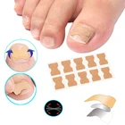 4-60 шт инструментов для ногтей полоски анти-ролл клей для ногтей носок Декор ногтей Корректор для ногтей пластырь коррекции наклейки на ногти для ног 