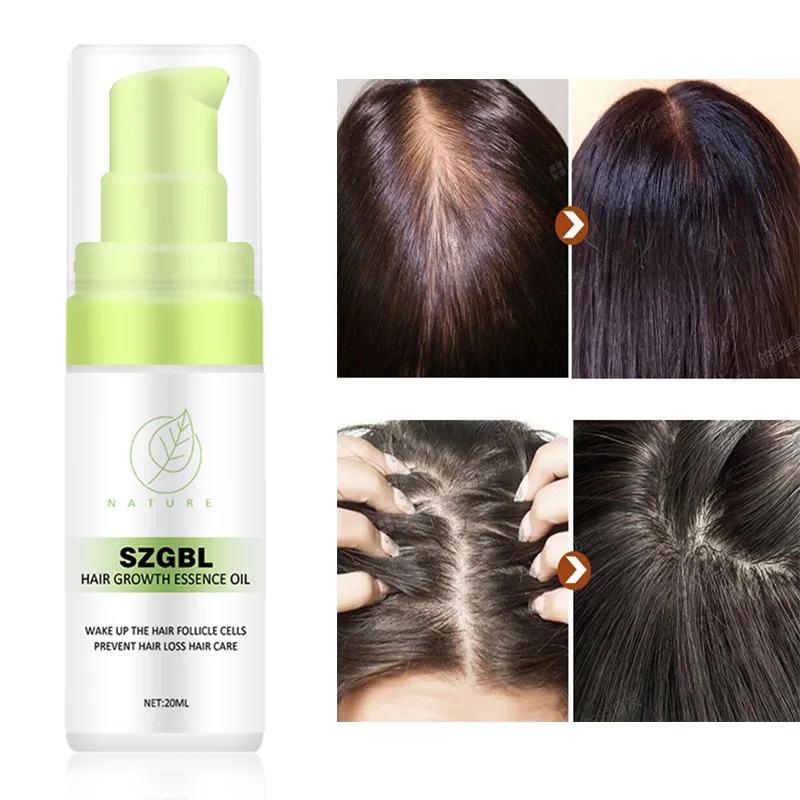 Мощная эссенция для роста волос продукты выпадения Эфирное Масло жидкое лечение