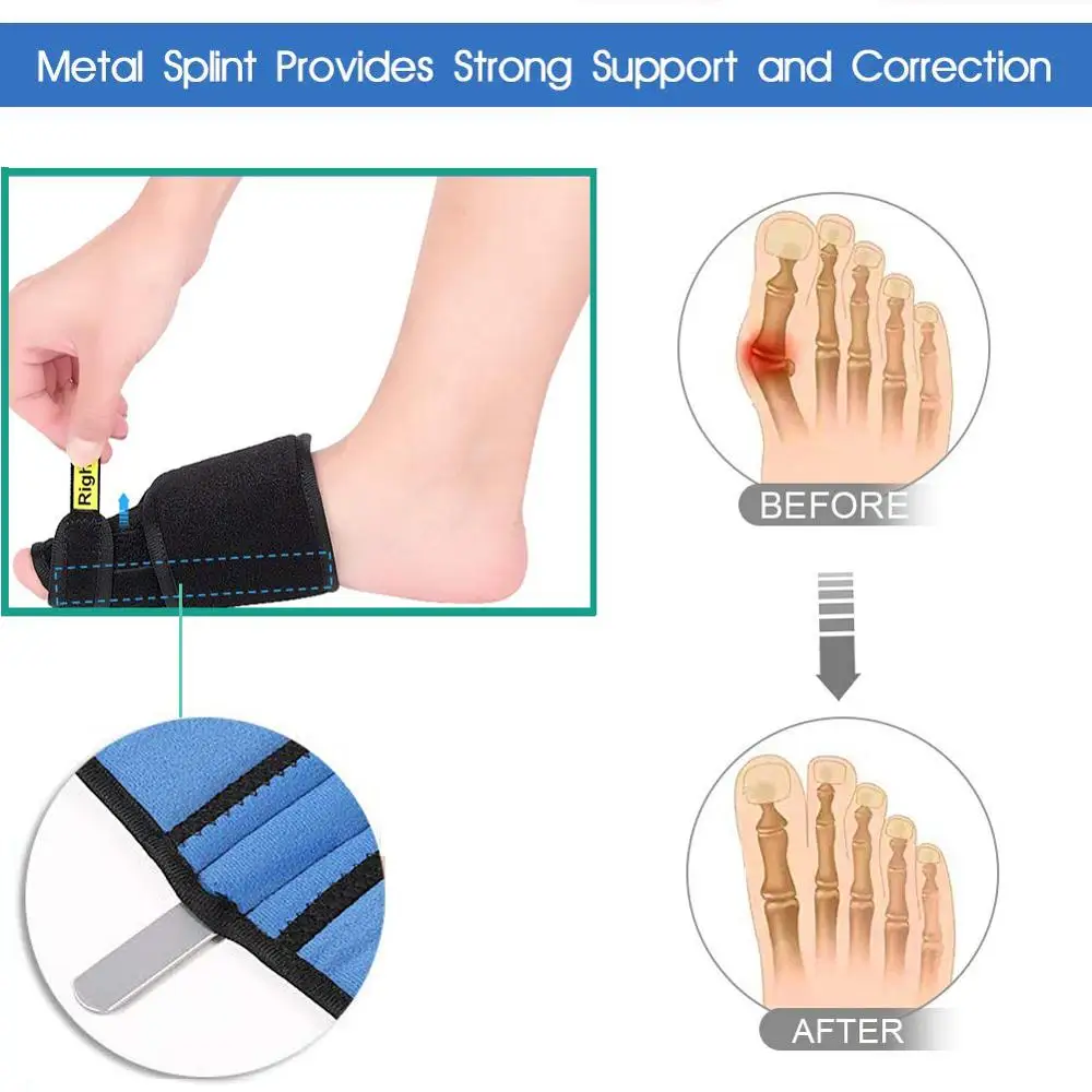 1Pair Toe Separator Hallux Valgus Bunion Corrector Orthotics Feet Bone Thumb Adjuster Correction Pedicure Sock Straightener | Красота и