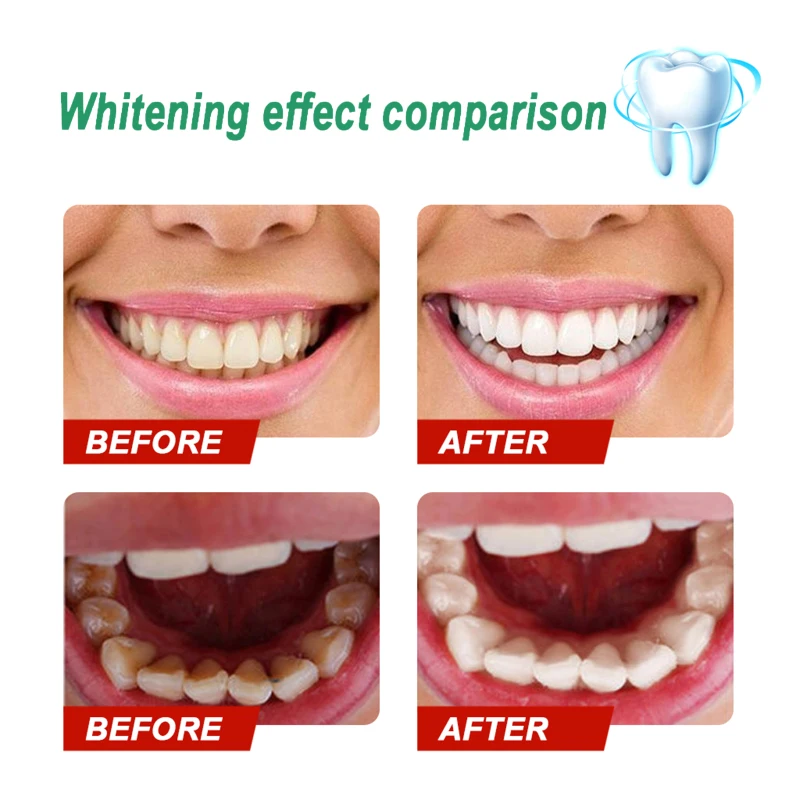 

Eelhoe Teeth Whitening Powder Clean Oral Hygiene Whiten Teeth Remove Plaque Stains Fresh Breath Oral Hygiene Care TSLM1