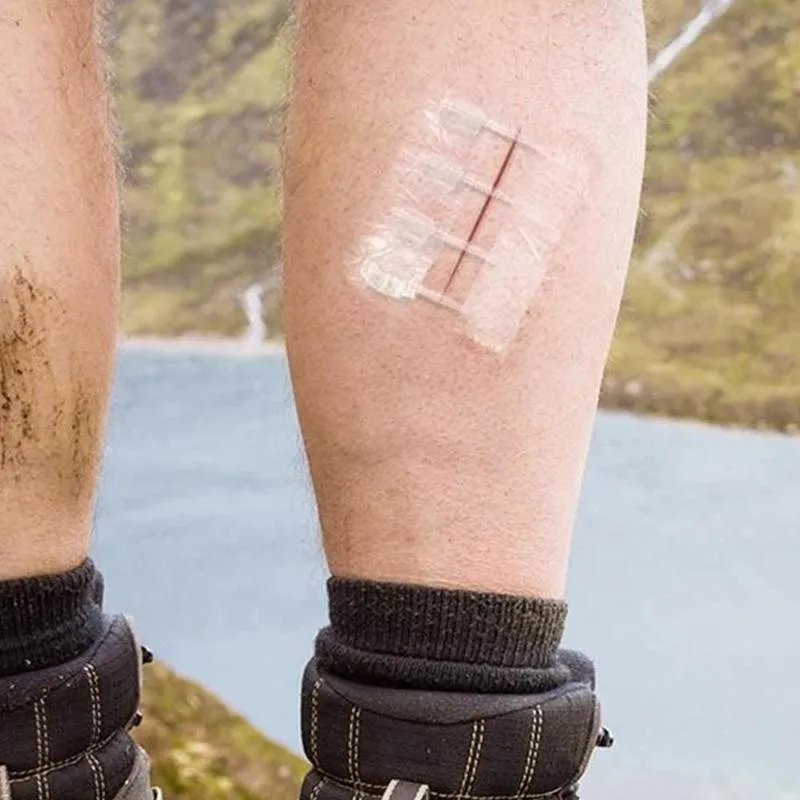 3 шт./компл. пластырь на молнии для улицы маленькая рана быстрый шов