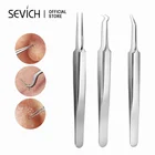 Иглы для удаления акне, инструменты для удаления черных точек, инструмент для ухода за лицом, лечение акне, игла для очищения пор, крючок, Шпилька для акне