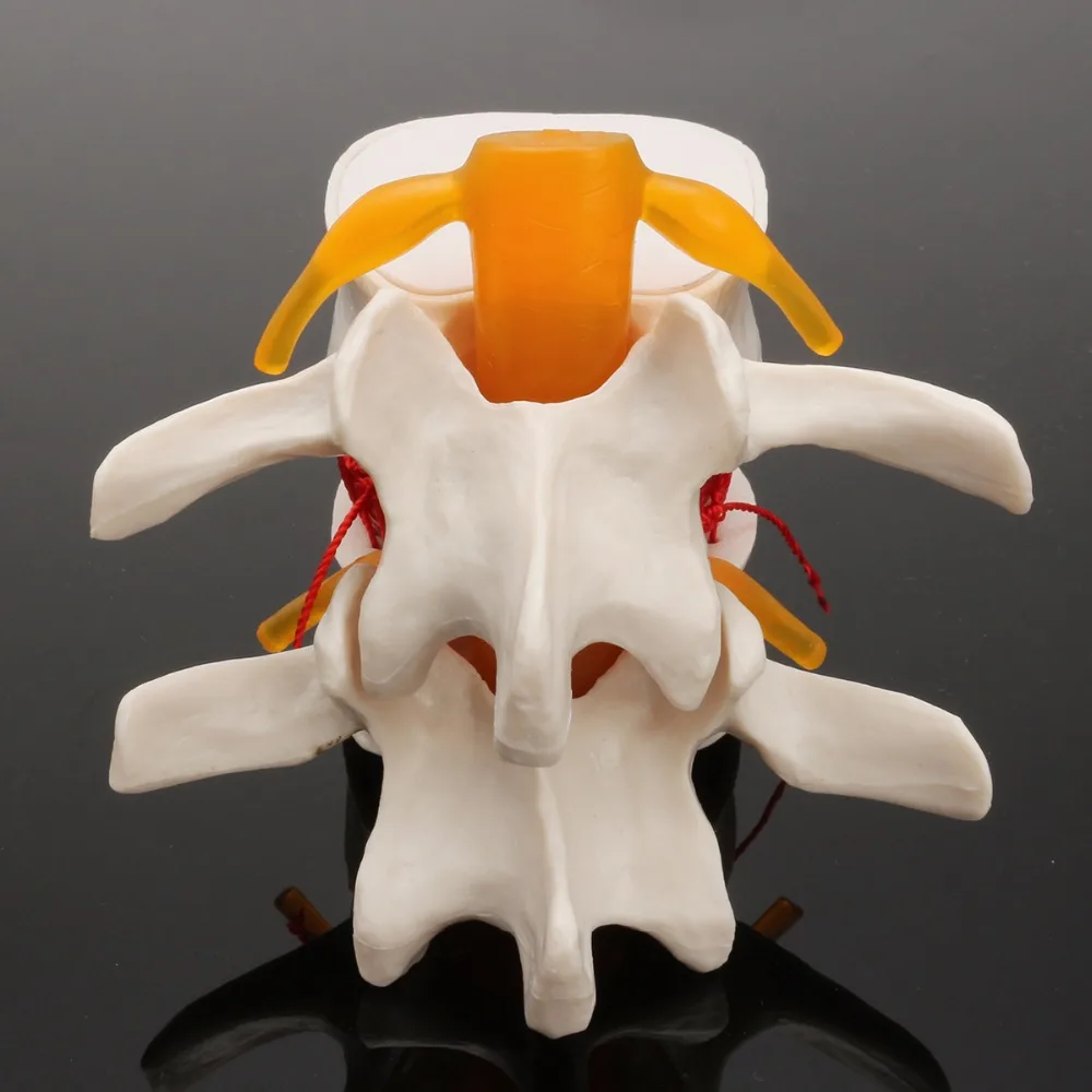 

Human anatomy skeleton Spine Lumbar Disc Herniation Teaching Model brain skull traumatic pistol school supplies medical instrume