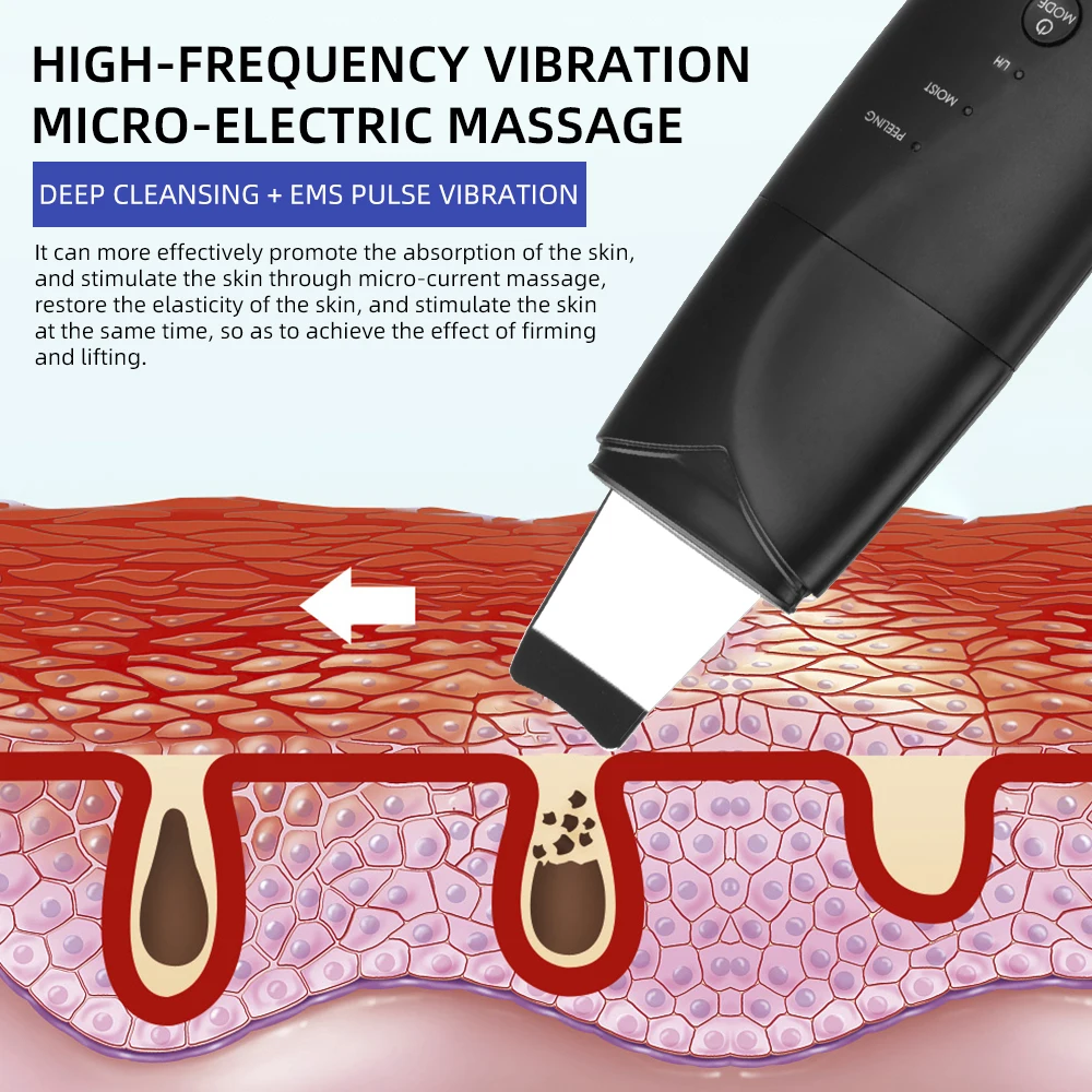 Kopen Gezicht Cleaner Ultrasone Huid Scrubber Usb Plug Comedondrukker Facial Massager Acne Huidverzorging Peeling Cavitatie