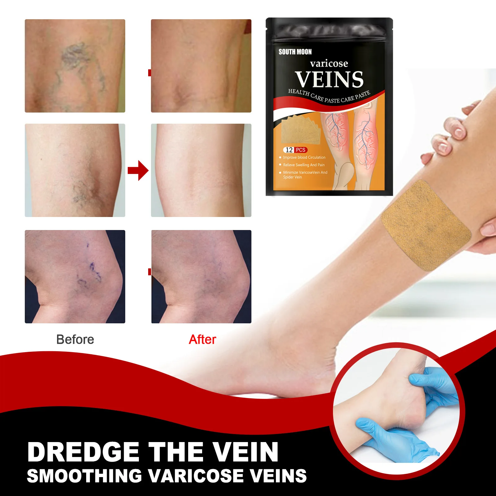 12PCS Varicose Veins Stickers Promoting Blood Circulations Pain Relief Patch for Eliminate Edema Nerve & Leg CJ | Красота и