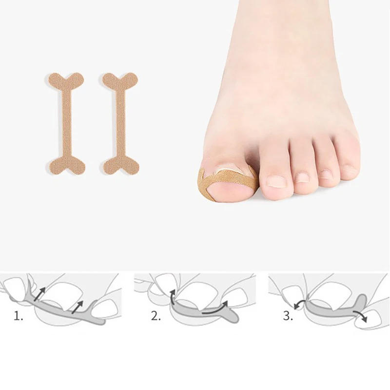 

1Set Ingrown Toenail Correction Tool Set Nail Pedicure Elastic Patch Nail Correction Lifter Pusher Clasp Brace Bunion Corrector