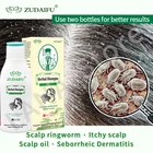 Травяной шампунь Zudaifu для ухода за волосами, псориаз, себорный лечебный экзема, дерматит, 120 мл