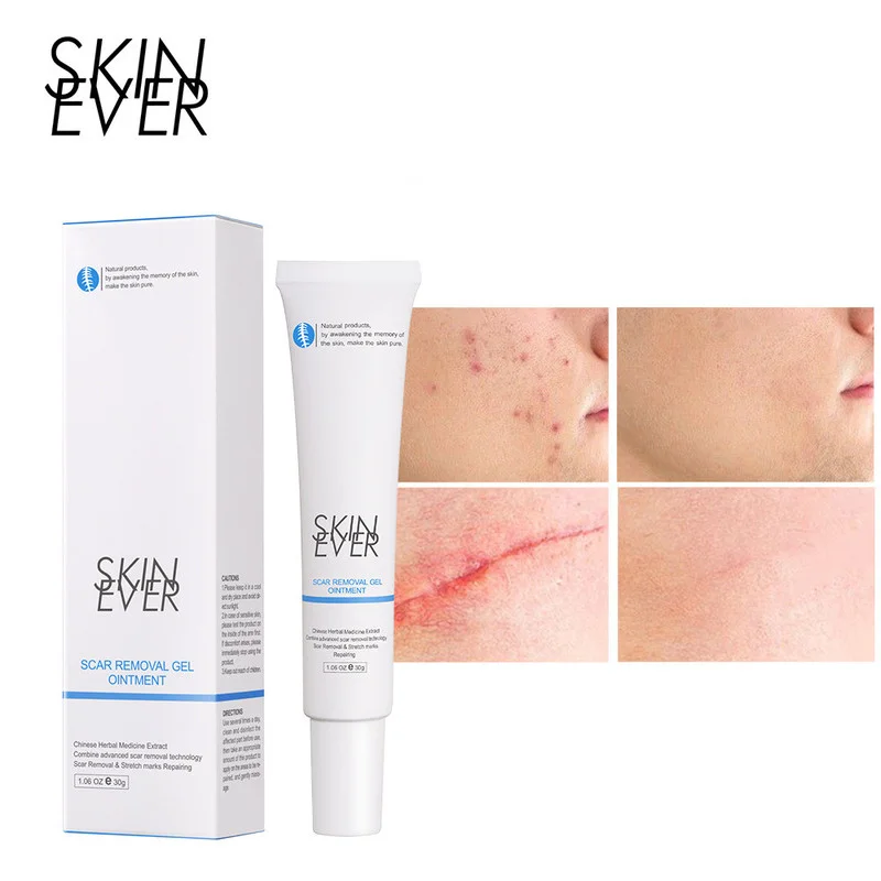 

30g Herbal Gel Can Repair and Fade Scars and Remove Acne Stretch Marks Facial Gel Body Care Skin Care Products