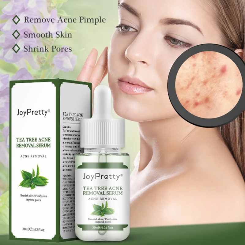 

30ml Fade Acne Spots Oil Control Whitening Moisturizing Skin Face Care Tea Tree Acne Treatment Acne Removal Serum Essence