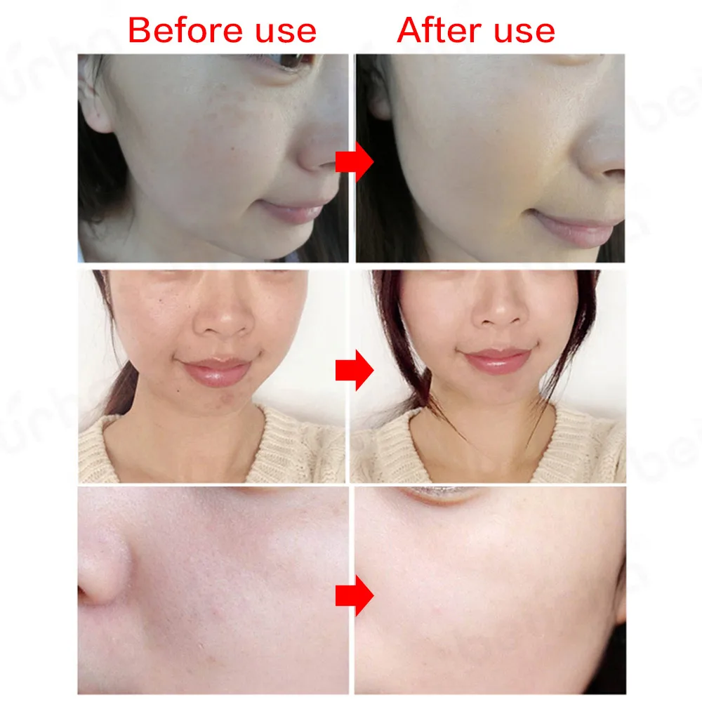 Маска светильник отбеливающая для лица светодиодный цветов | Красота и здоровье