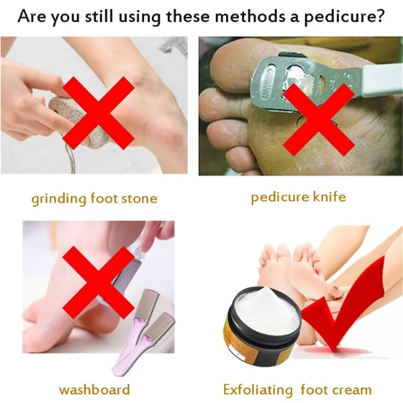 Крем для ног конского масла 1 шт. крем пяток маска против мозолей от зуда удаление