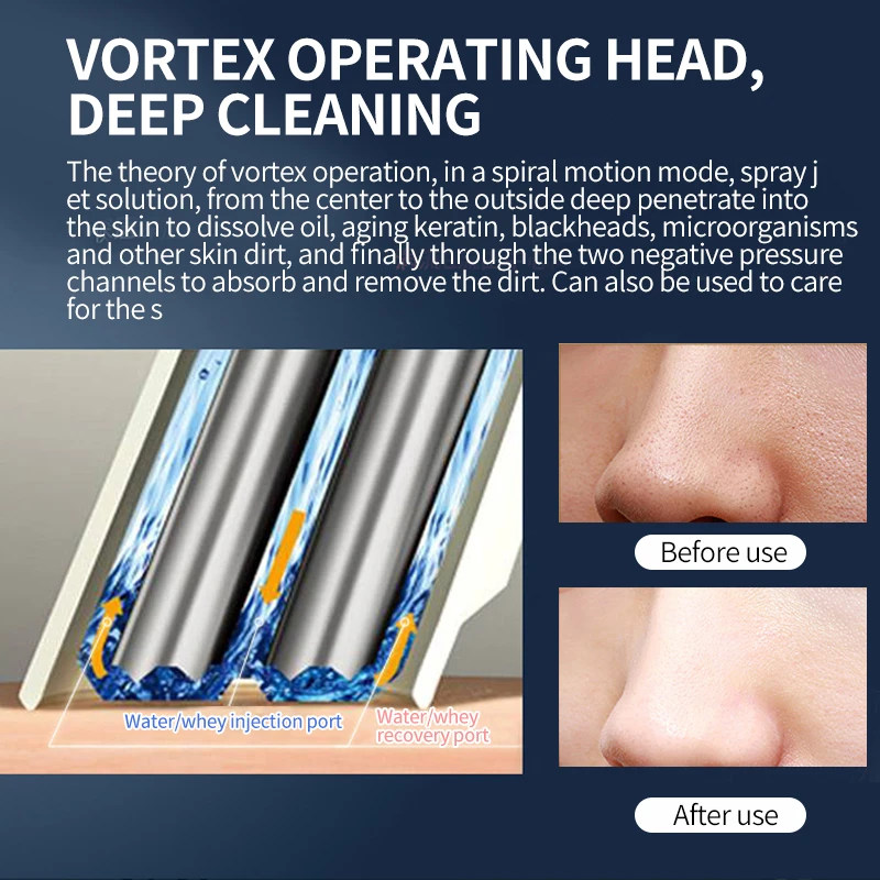 

Water Cycle Blackhead Remover Small Bubbles Vacuum Face Cleaner Face Care Acne Remover Beauty Skin Tag Remover Skin Care