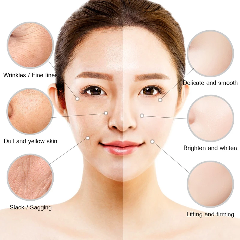 

Acne Treatment Face Cream Scar Blackhead Remover Repair Gel Oil Control Shrink Pores Whitening Creams Skin Care Korean Cosmetics
