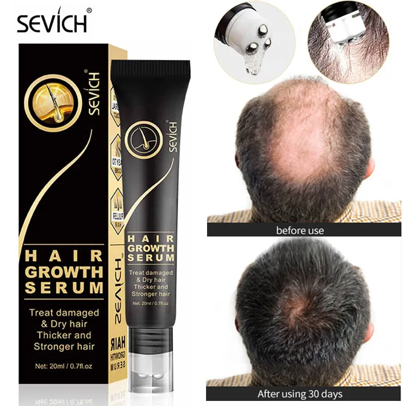 

Sevich Hair Growth Products Essential Oil Anti Hair Loss Treatment Roller Massage Scalp Repair Damaged Natural Health Hair Care