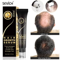 sevich hair growth products essential oil anti hair loss roller massage scalp treatment repair damaged natural health hair care
