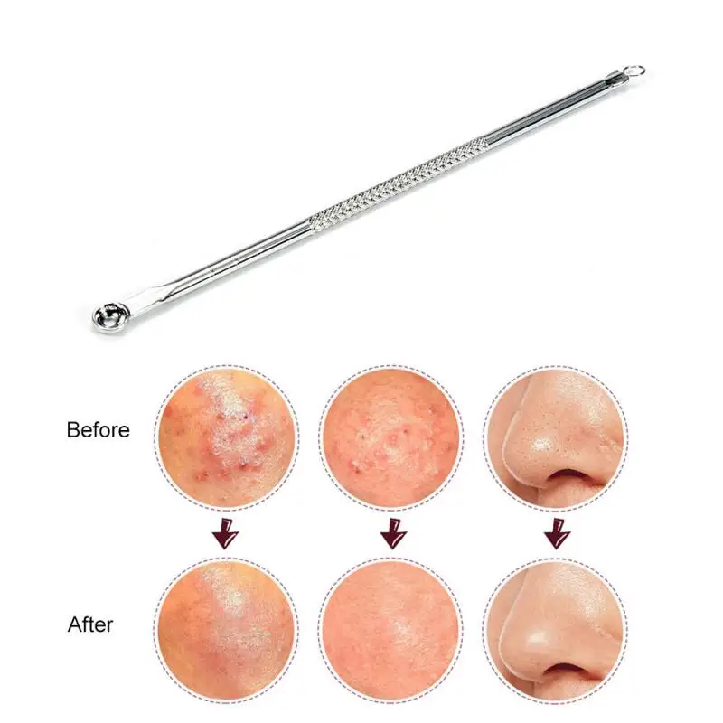 

Stainless Steel Extractor Blackhead Remover Needles Dots Cleaner Acne Blemish Remover Needles Set Black Spot Pore Cleanser