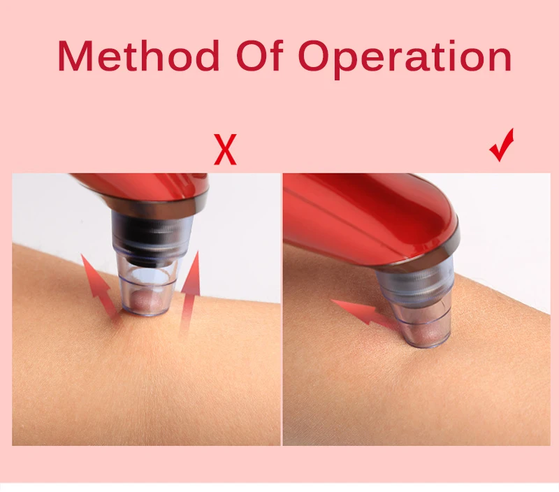 Blackhead Remover Vacuum Suction Face Deep Pore Cleaner Electric Acne Pimple Remover Tool Dark Spot Remover for Face Beauty Tool