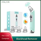 Аппарат для удаления черных точек Anlan, вакуумный, для ухода за кожей лица