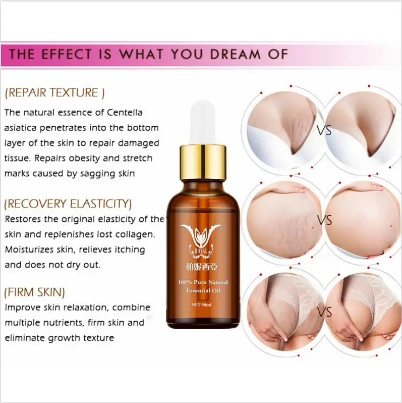 Эфирные масла для Удаления растяжек натуральное средство удаления ожирение