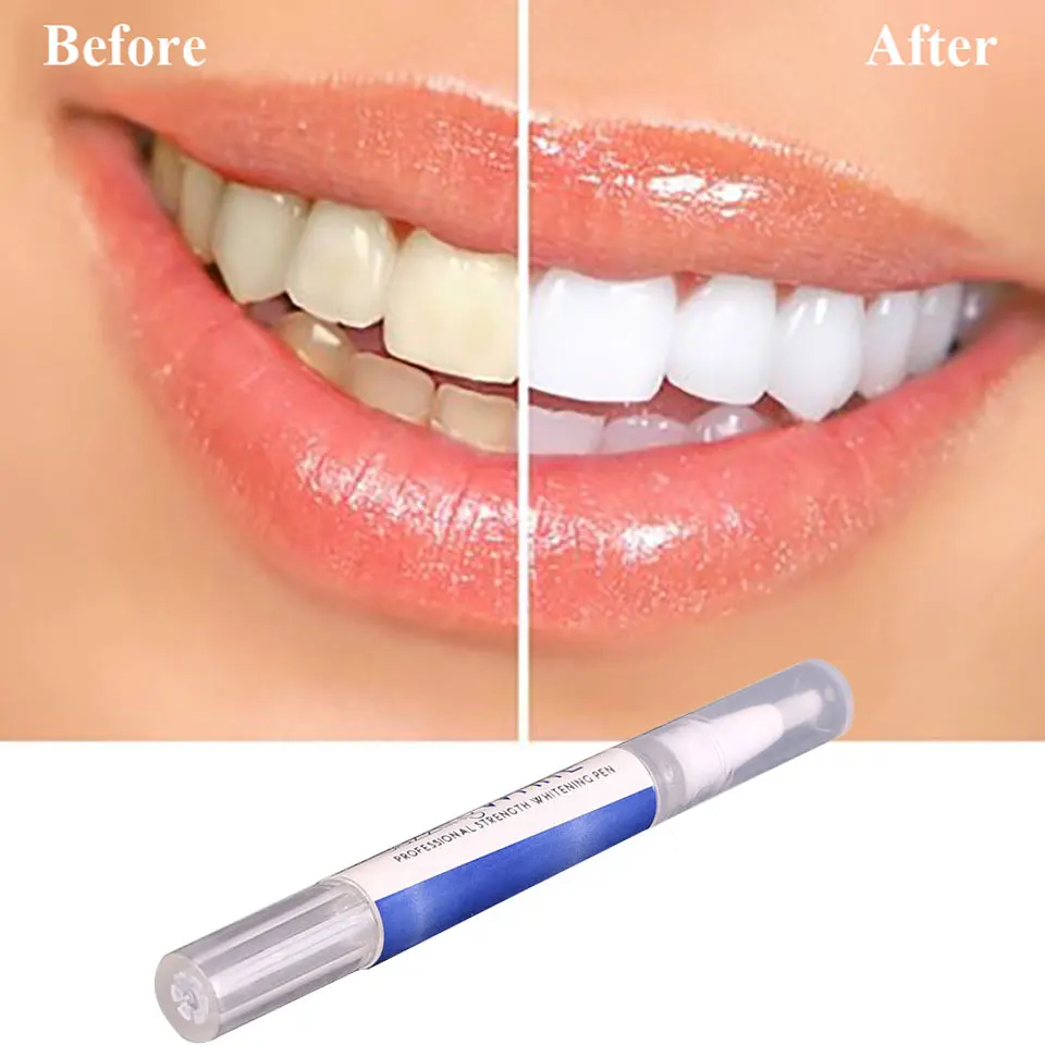 1 шт. эффективное отбеливание зубов ручка гель отбеливатель пятен Ластик