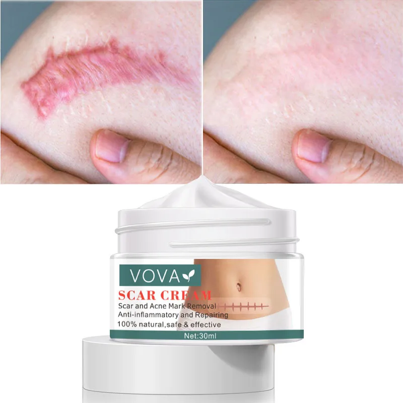 

Scar Repair Cream Repair Burn Scars, Promote Cell Regeneration, Increase Elasticity, Facial Skin Cream Acne Scar Removal Cream