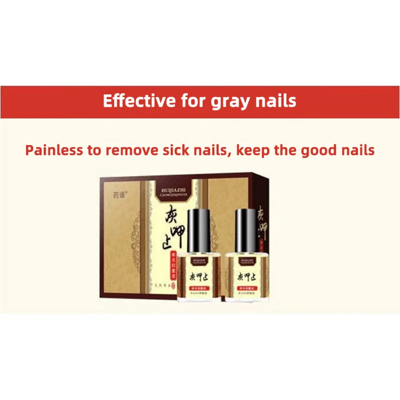 Средство для удаления грибка на ногтях средство ремонта и устранения зуда |