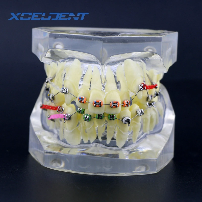 1 шт. Ортодонтические дентальные лечение прикуса Модель W/Кронштейны цепи провода