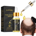 Эфирные масла имбиря против выпадения волос, жидкость для роста волос, восстановление сухих вьющихся поврежденных, быстрый уход за волосами