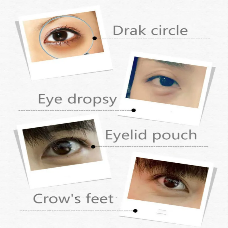 Электрический массажер для глаз вибрационная ручка красоты против морщин темный