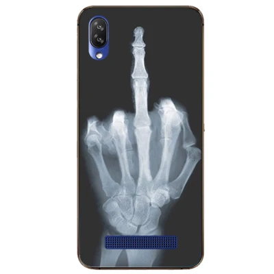 Чехол Для Doogee Y8C 6 1 дюйма Роскошный чехол из ТПУ и силикона s задняя крышка для