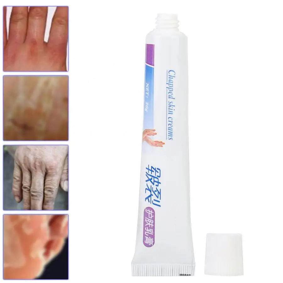 Крем для лечения сухого трещины рук на пятке шелушение Исцеление крем 20 г массаж